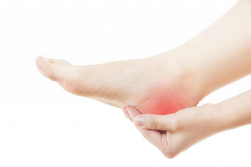 Fisioterapia y podología para fascitis plantar