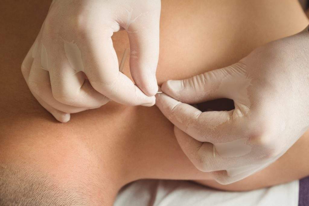 Tratar la cervicalgia