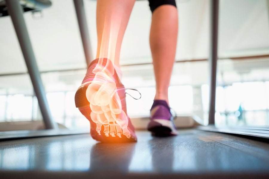 estudio-de-la-pisada