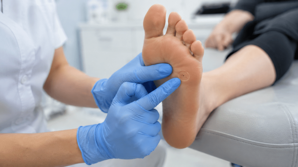 Tratamiento del Papiloma Plantar en Getafe mediante Multipunción